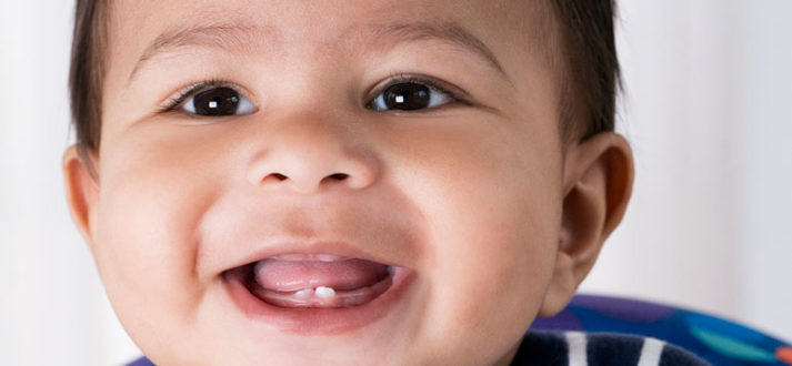 Protecting The Dental Health Of Your Child