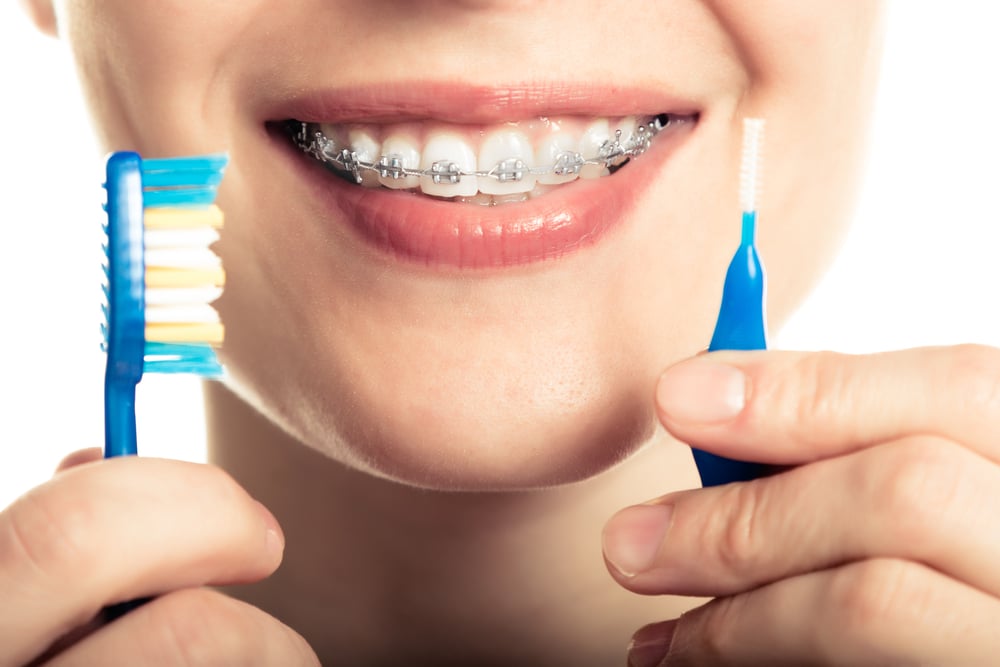 Best Ways To Clean Your Teeth Braces - Partha Dental 130+