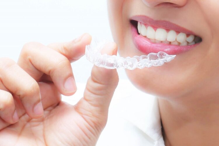 invisible aligners treatment
