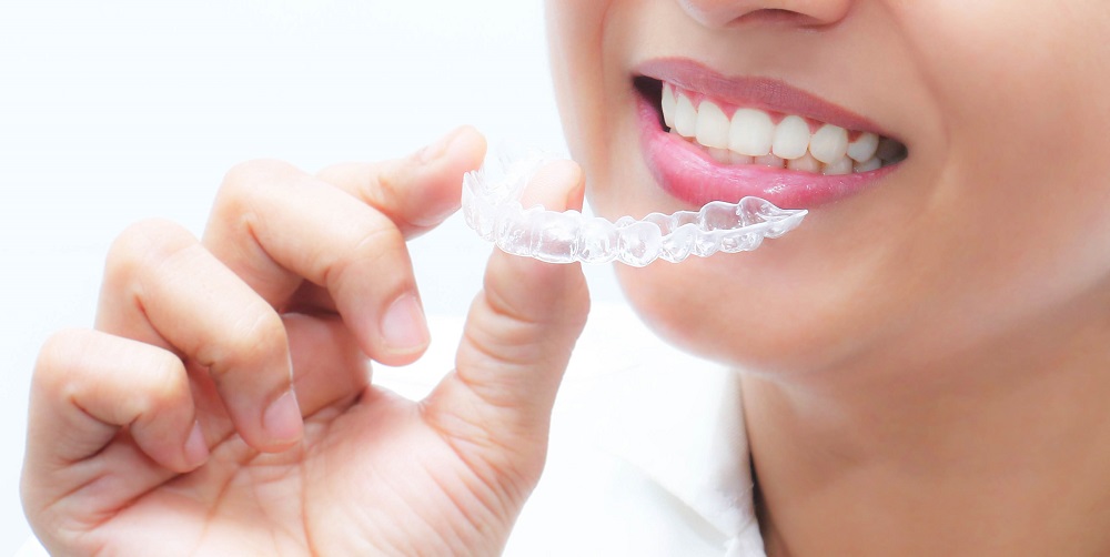 invisible aligners treatment