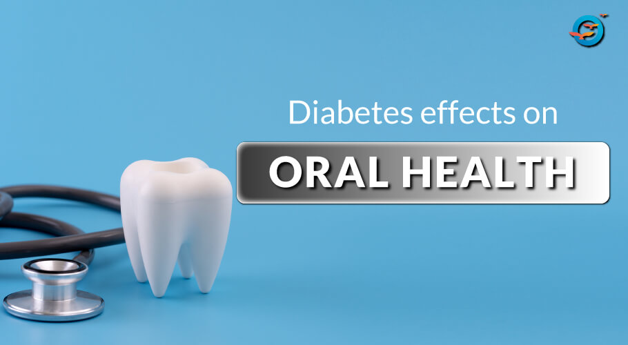 Diabetes And Dental Care