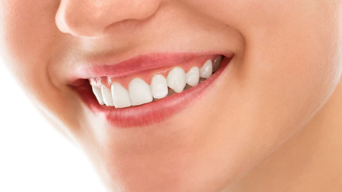 A Closer Look At Dental Fillings | Best Dental Clinic 130+