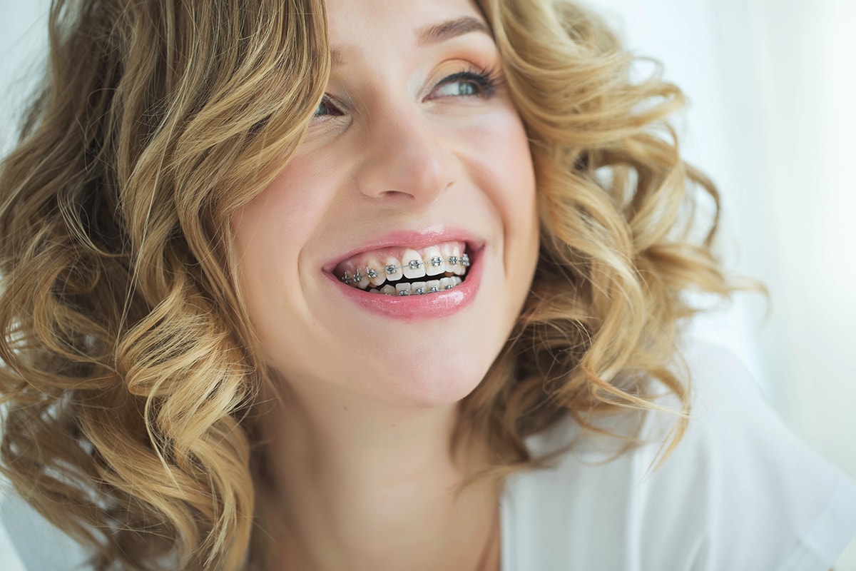 4 Reasons To Get Adult Tooth Braces | Best Dentist - 130+