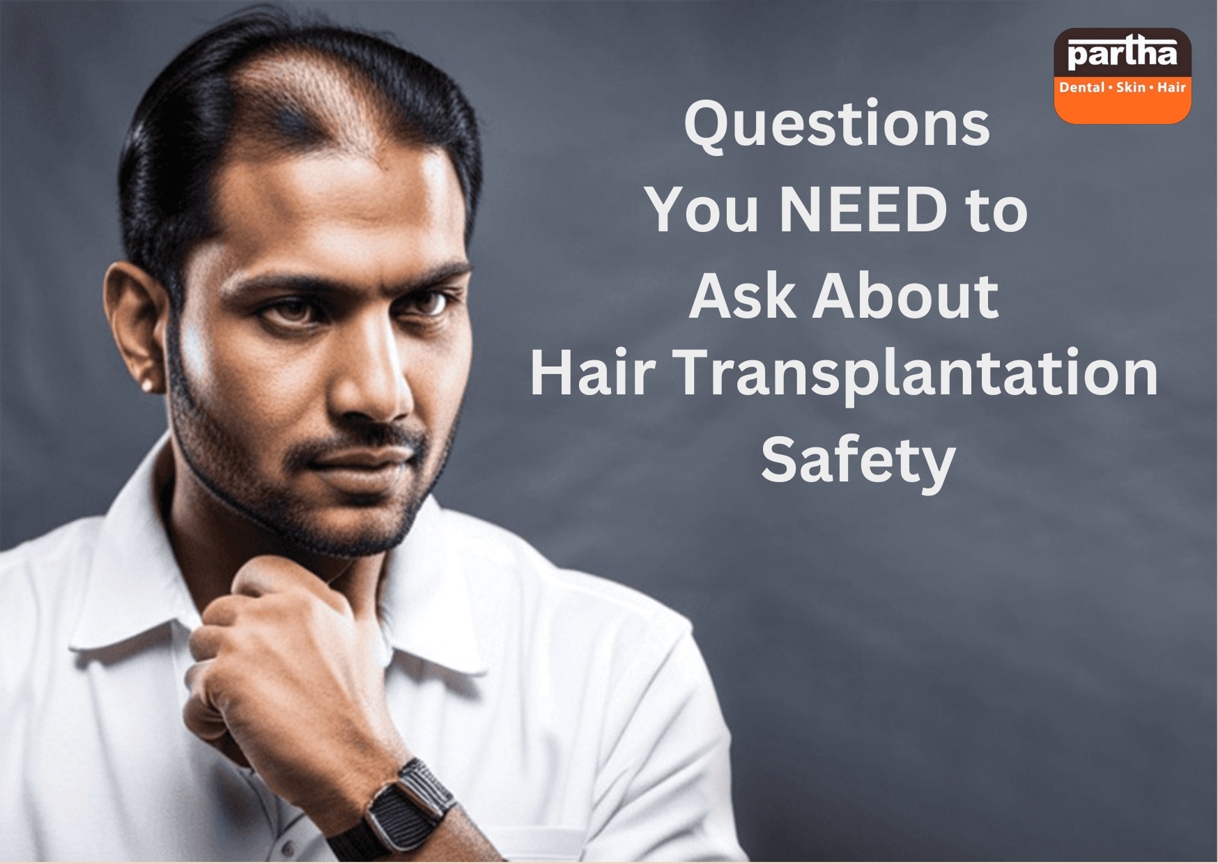 Top 5 Questions You Need To Ask About Hair Transplantation