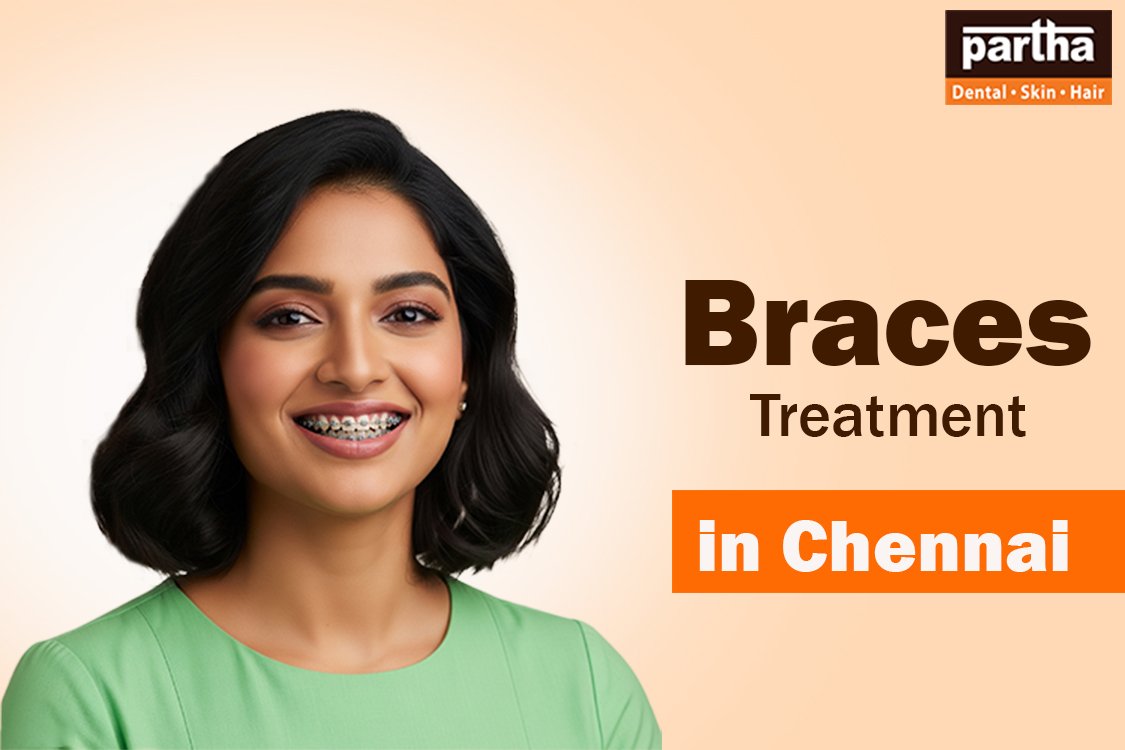 Braces treatment in Chennai