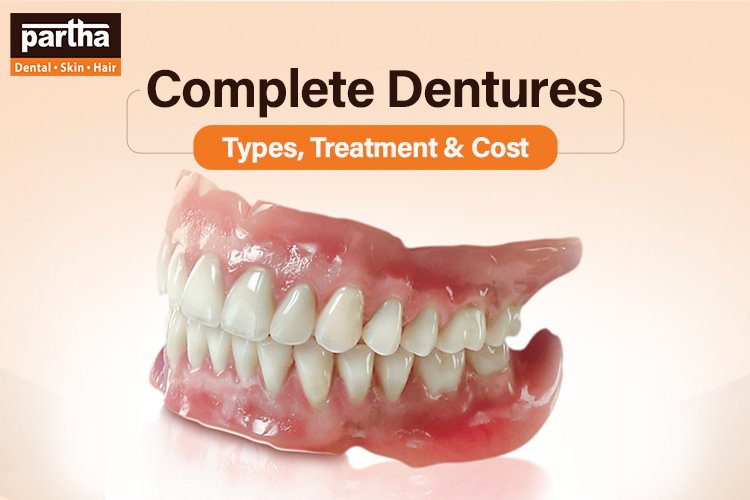 Complete Dentures