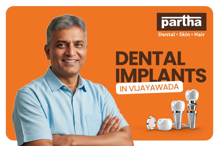 DENTAL IMPLANTS VIJAYAWADA