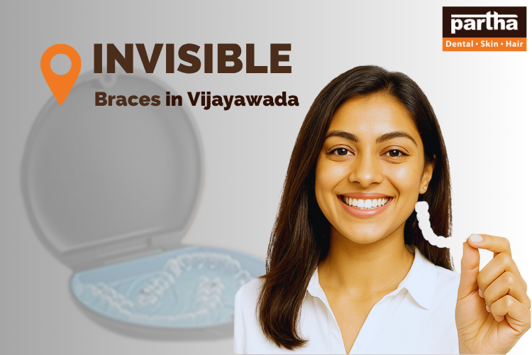 From MG Road to Benz Circle: Where to Get the Best Invisible Braces in Vijayawada 1 Invisible braces in Vijayawada