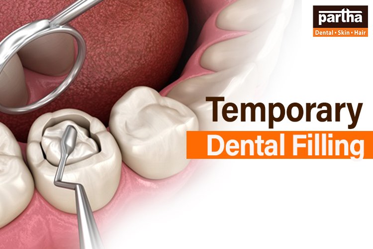 dental filling 750 500