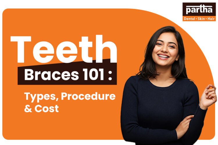 Braces 101