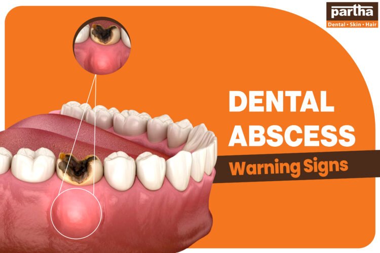Dental Abscess Warning Signs 2