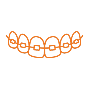 Dental Braces