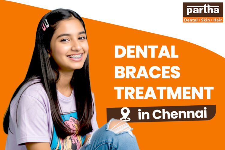Dental braces 750 500 3