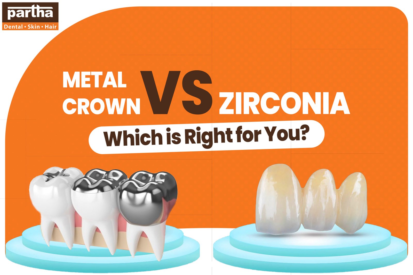 Metal Vs Zirconia 1 scaled