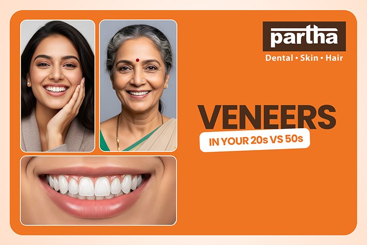 PARTHA DENTAL BLOG IMAGE 08 750X500
