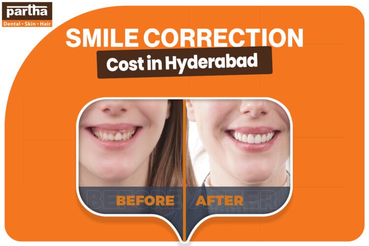 Smile Correction 1
