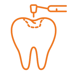 Teeth Filling