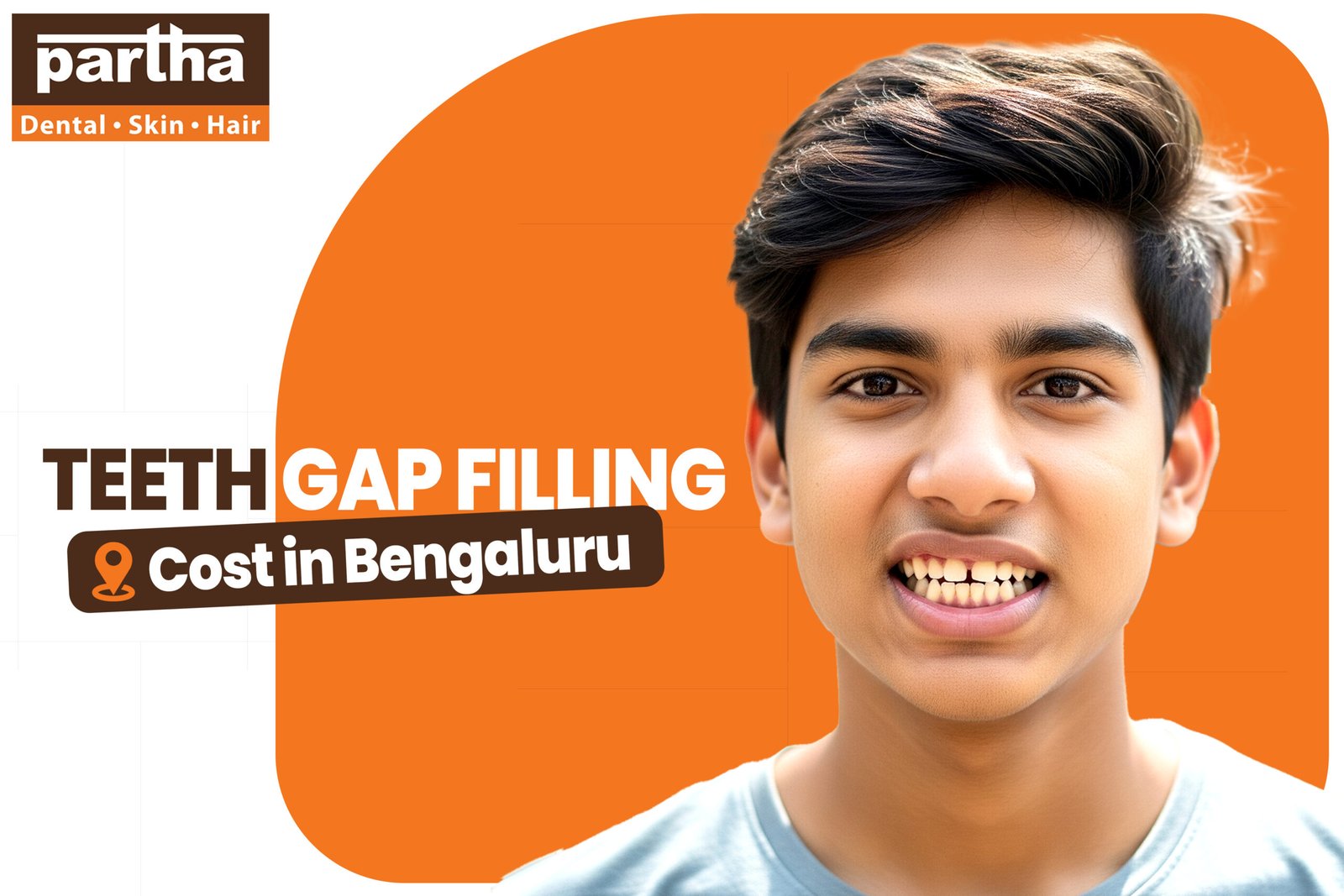Teeth Gap Filling scaled