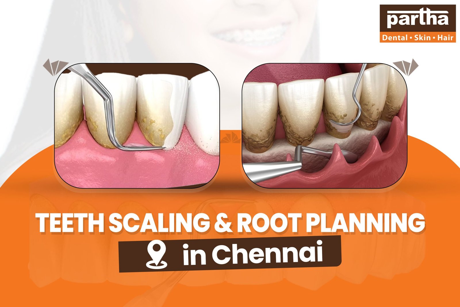 Teeth Scaling Root Planning 1 scaled