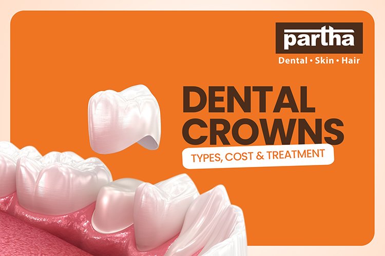 dental crowns