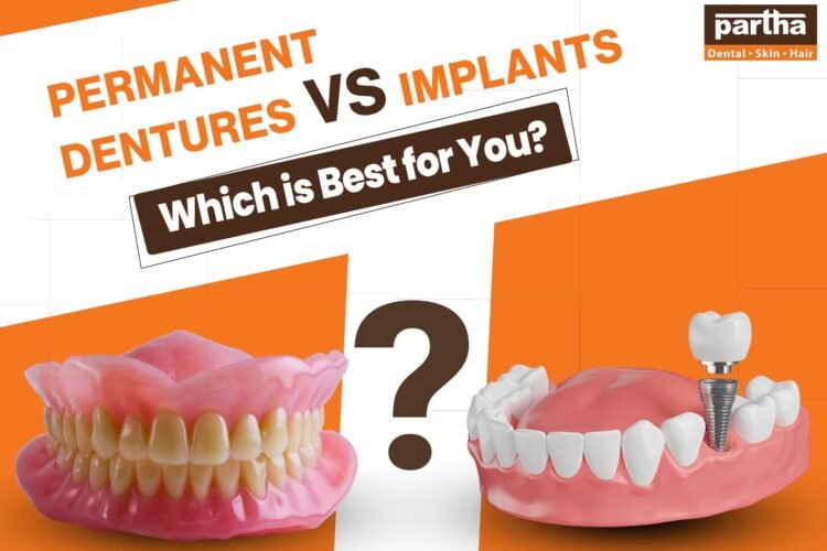 dentures vs implants
