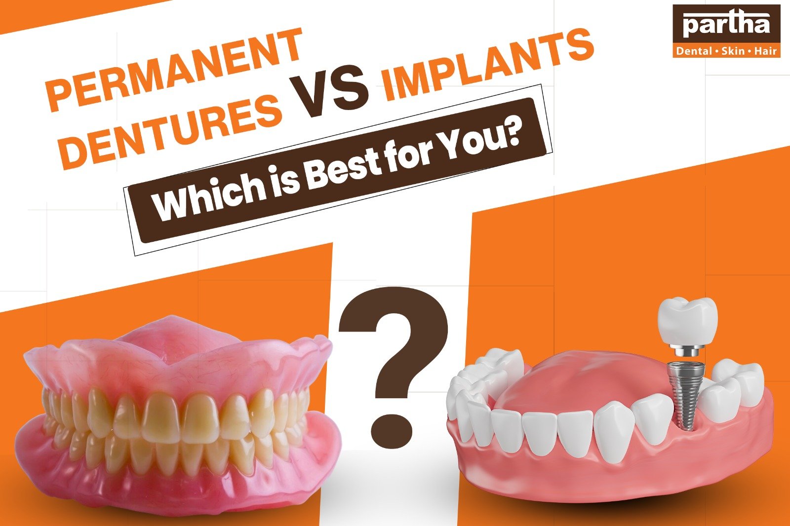 dentures vs implants