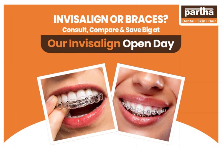 invisalign vs braces