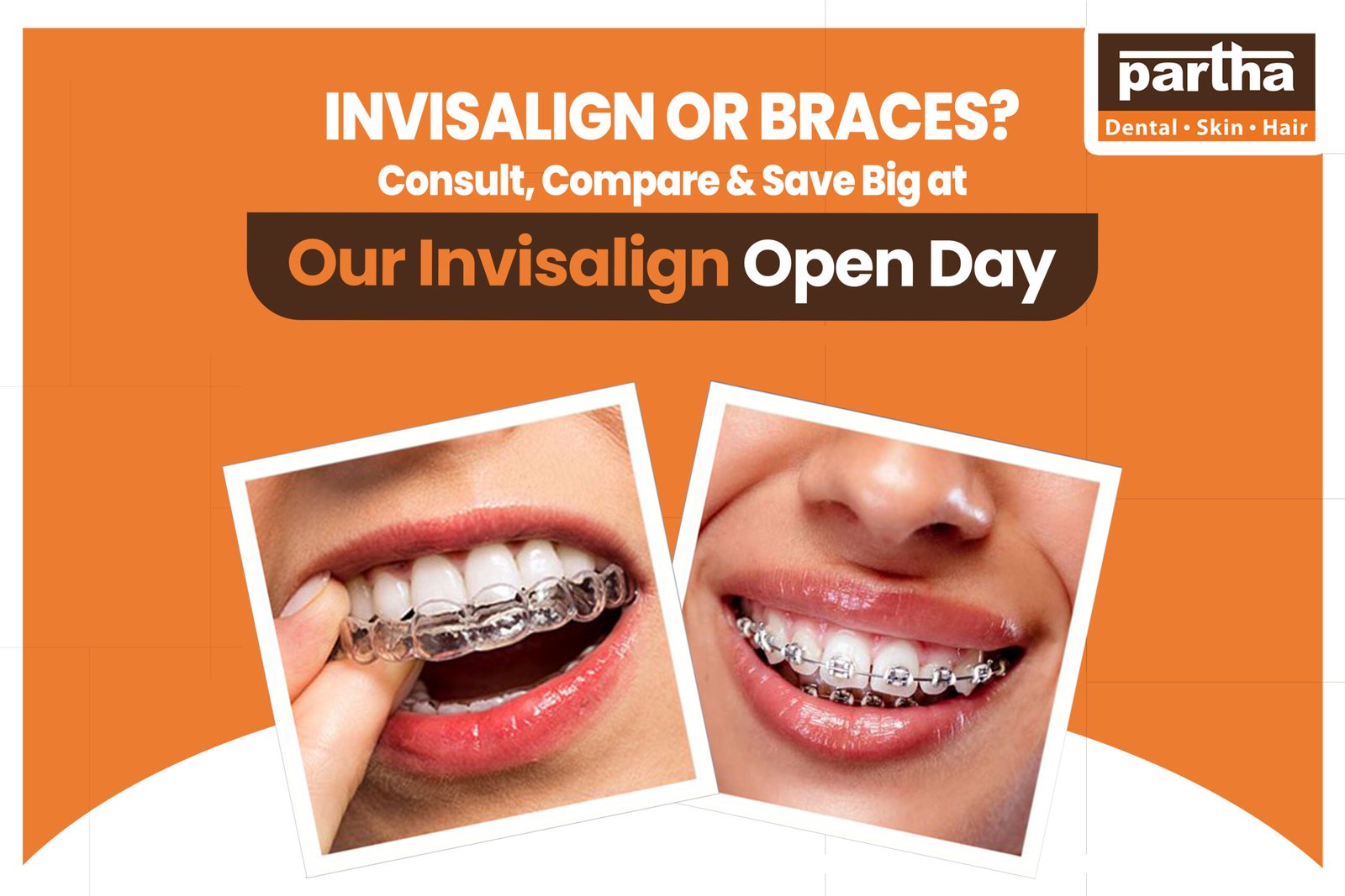invisalign vs braces scaled