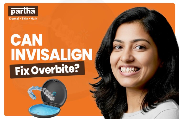 Can invisalign fix overbite
