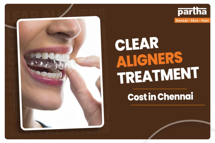 Clear aligners treatment cost in chennai