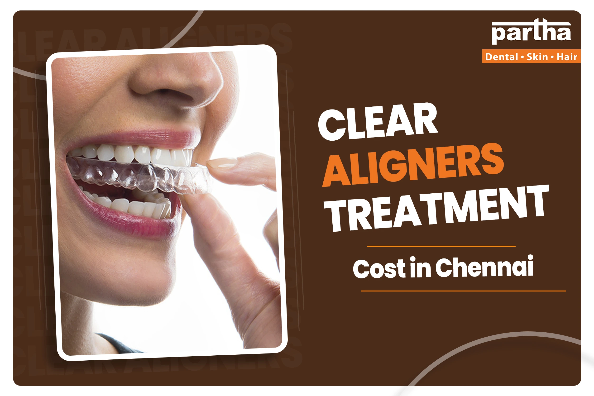 Clear aligners treatment cost in chennai