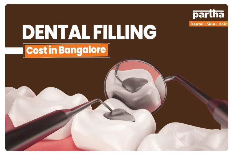 Dental Filling cost in bangalore