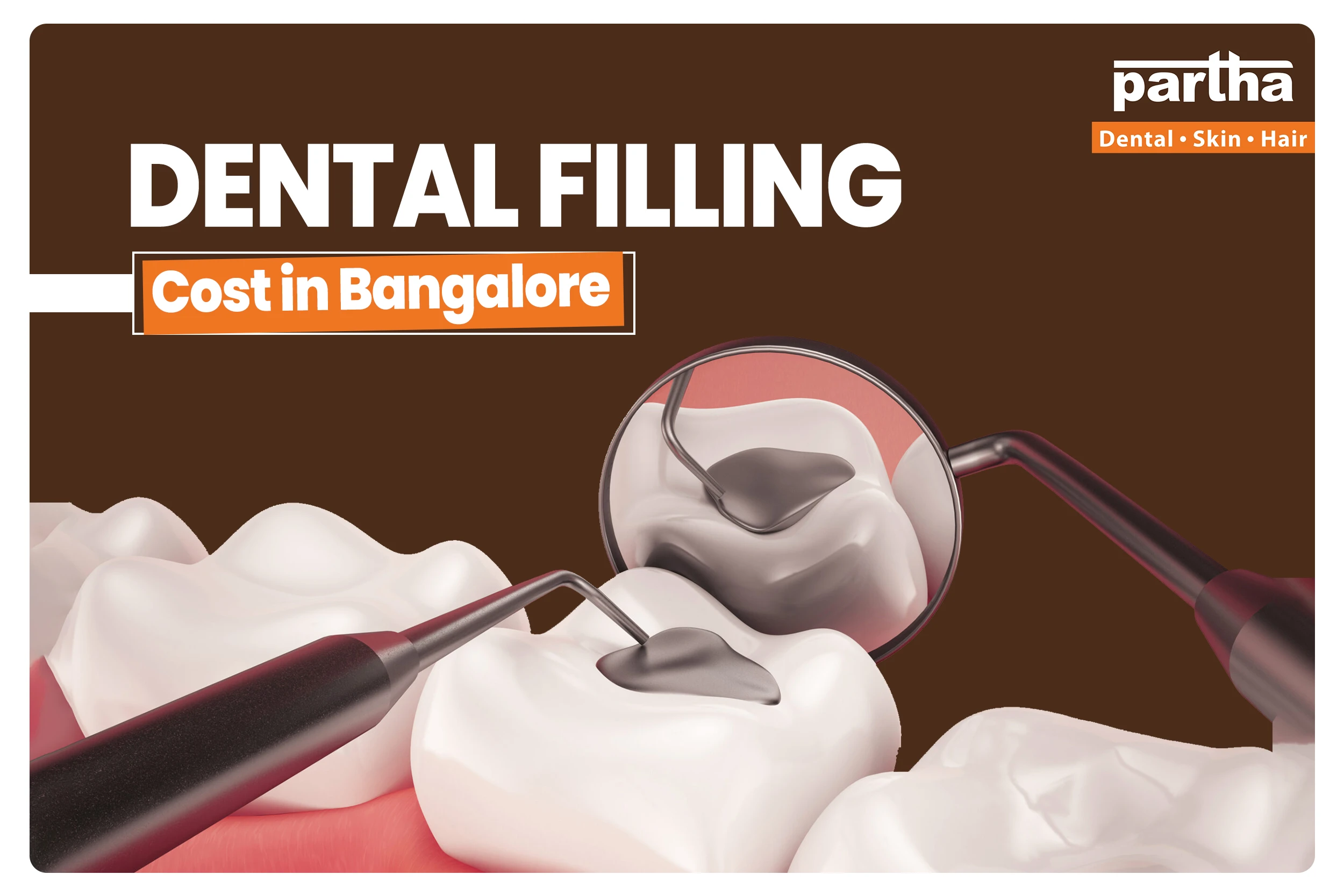 Dental Filling cost in bangalore