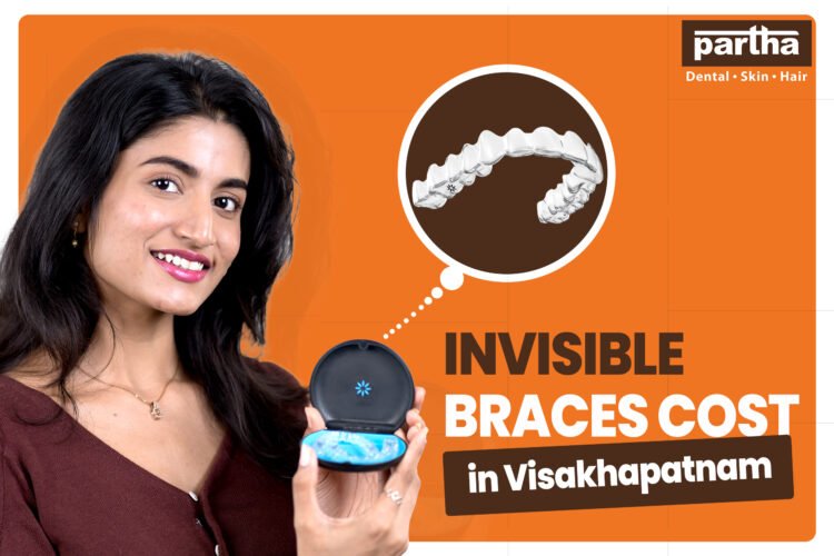 Invisible Braces (Clear Aligners) Cost in Visakhapatnam 1 Invisible braces costin vigz