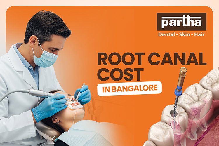 Root Canal (RCT) Cost in Bangalore – Partha Dental 1 RCT cost in bangalore