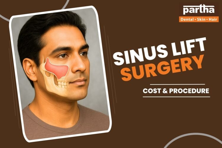 SINUS LIFT SURGERY