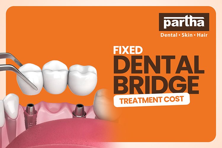 fixed dental bridge