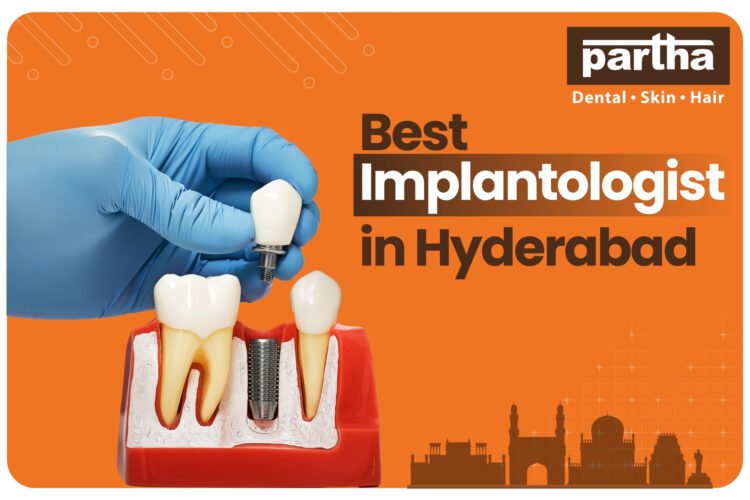 implantologist in hyderabad