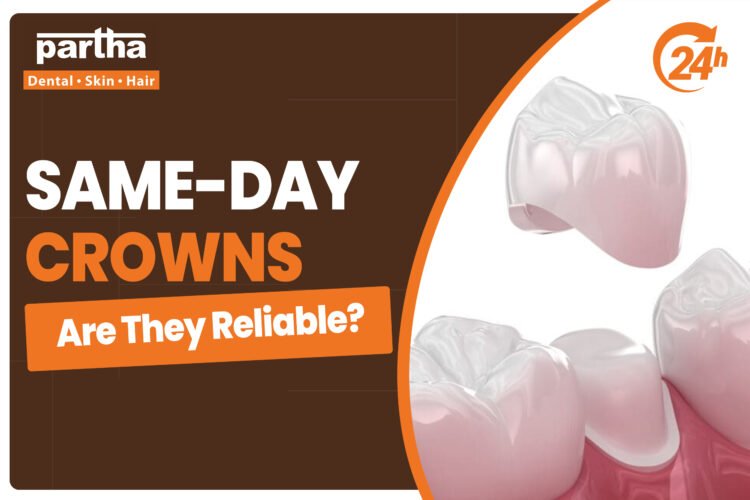 same day crowns 1