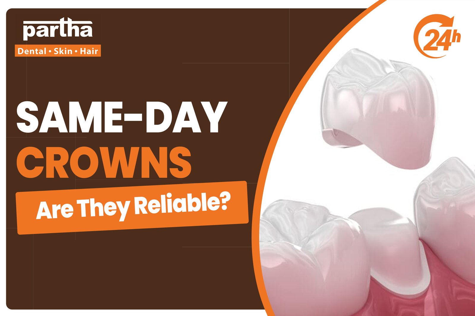 same day crowns 1