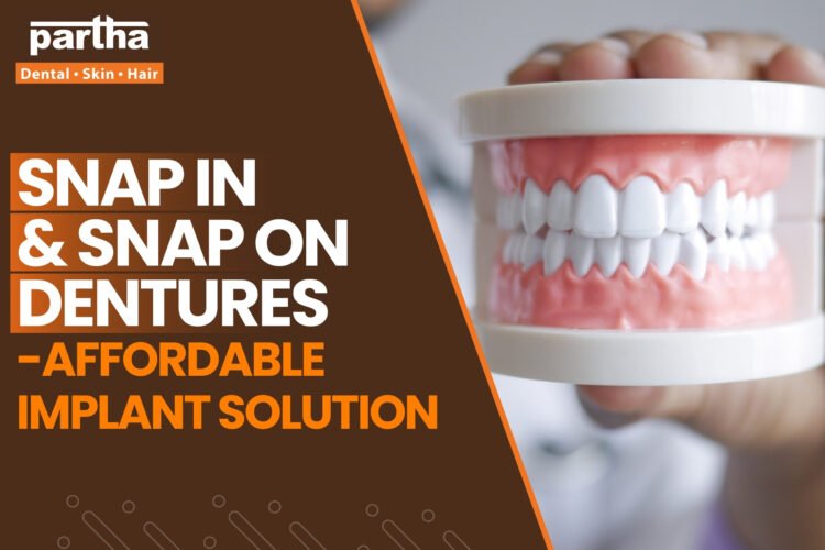snap on dentures