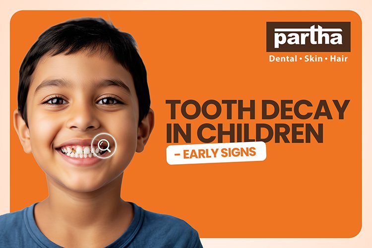 tooth decay in children