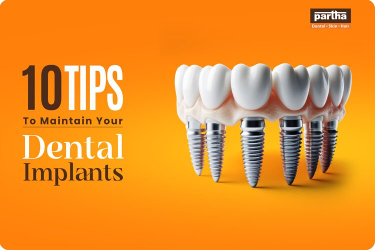 10 Tips to Maintain Your Dental Implants