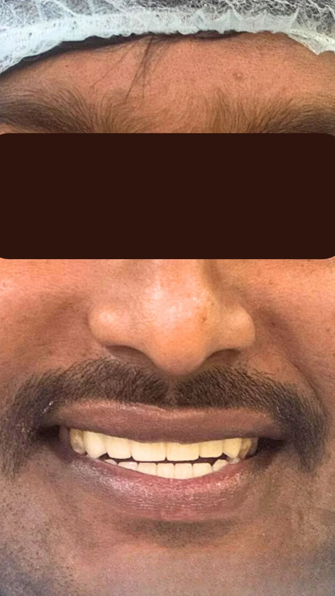 4 1