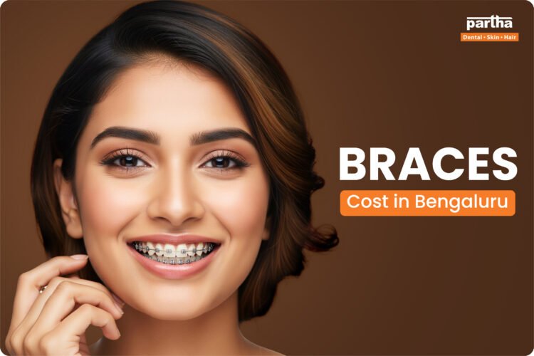 Braces Cost in Bangalore