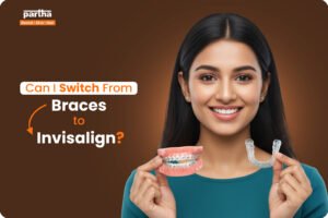 Can I Switch From Braces to Invisalign