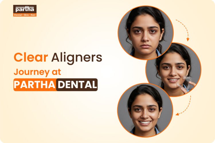 Clear Aligners Journey at Partha Dental