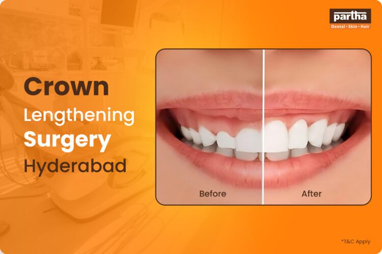 Save Big on Invisalign & Partha Aligners