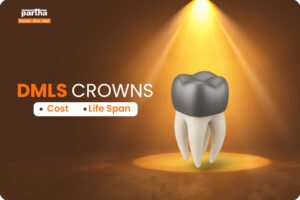 DMLS Crowns Cost Life Span 1