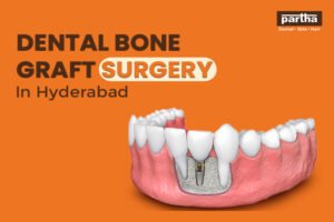 Dental Bone Graft Surgery Cost in Hyderabad 1